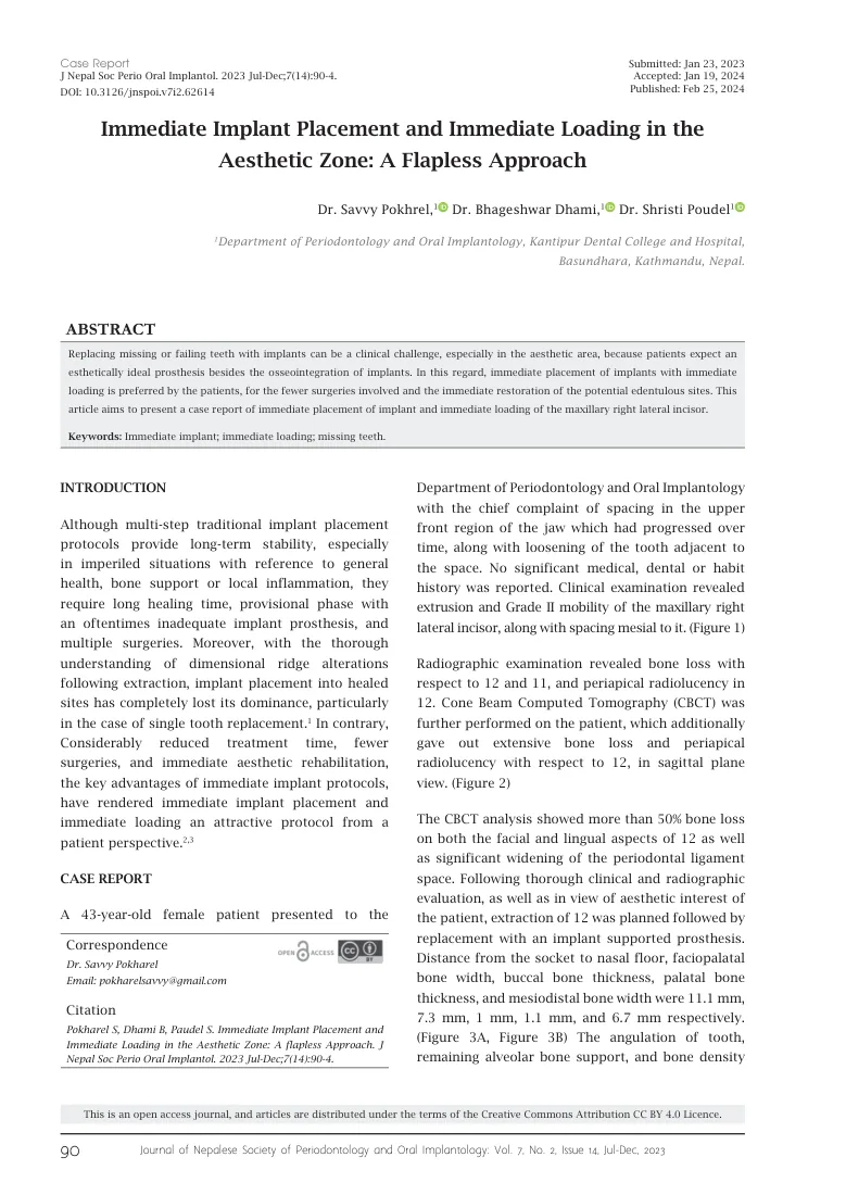 Immediate implant placement and immediate loading in the aesthetic zone: a flapless approach — page preview