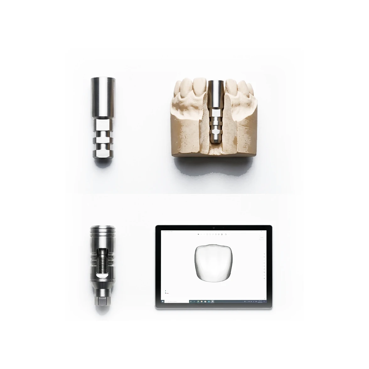 Two workflows in i-Fix components: conventional — impression coping, impression, implant analog, model, abutment, restoration; digital — scan body, intraoral scan, digital library, digital analog, Ti base or abutment, restoration
