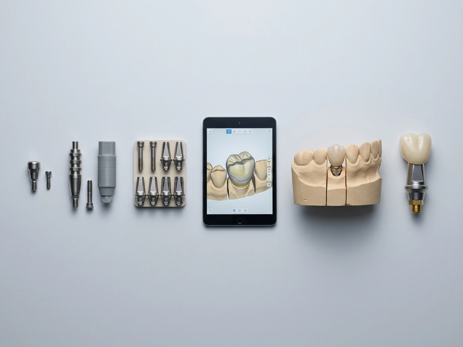 The full prosthetic workflow in sequence: healing abutment, impression or scan, abutment selection, laboratory or CAD-CAM, try-in, final restoration