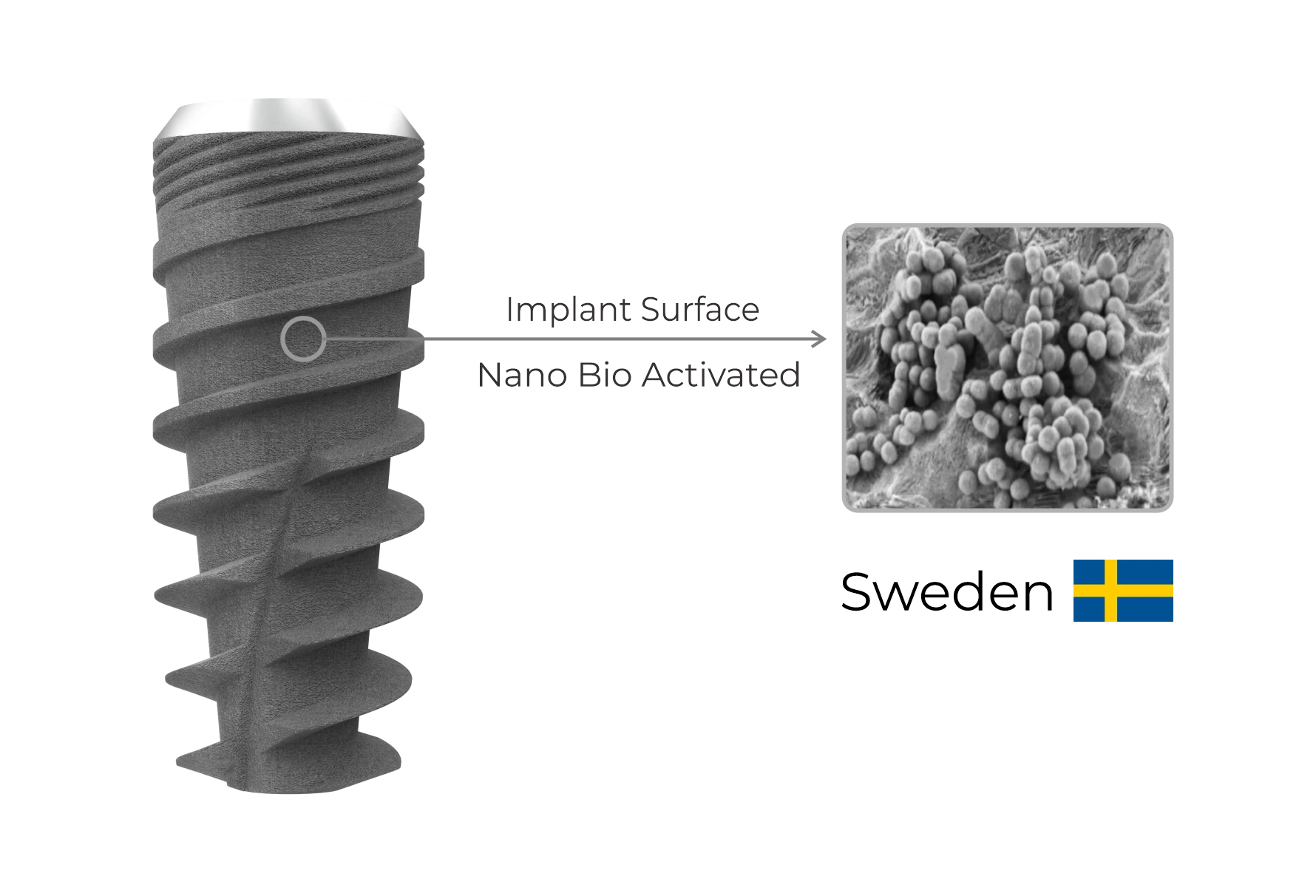 Surface — i-Fix implant design
