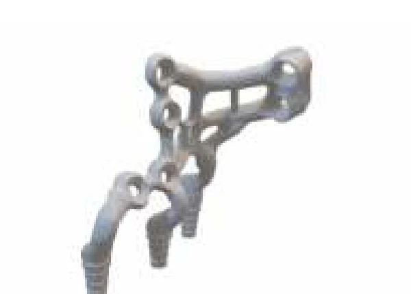 Immediate Loading — Cement Retained — PSI Series prosthetic interface